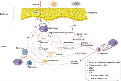 The Theranostics Role of Mast Cells in the Pathophysiology of Rosacea